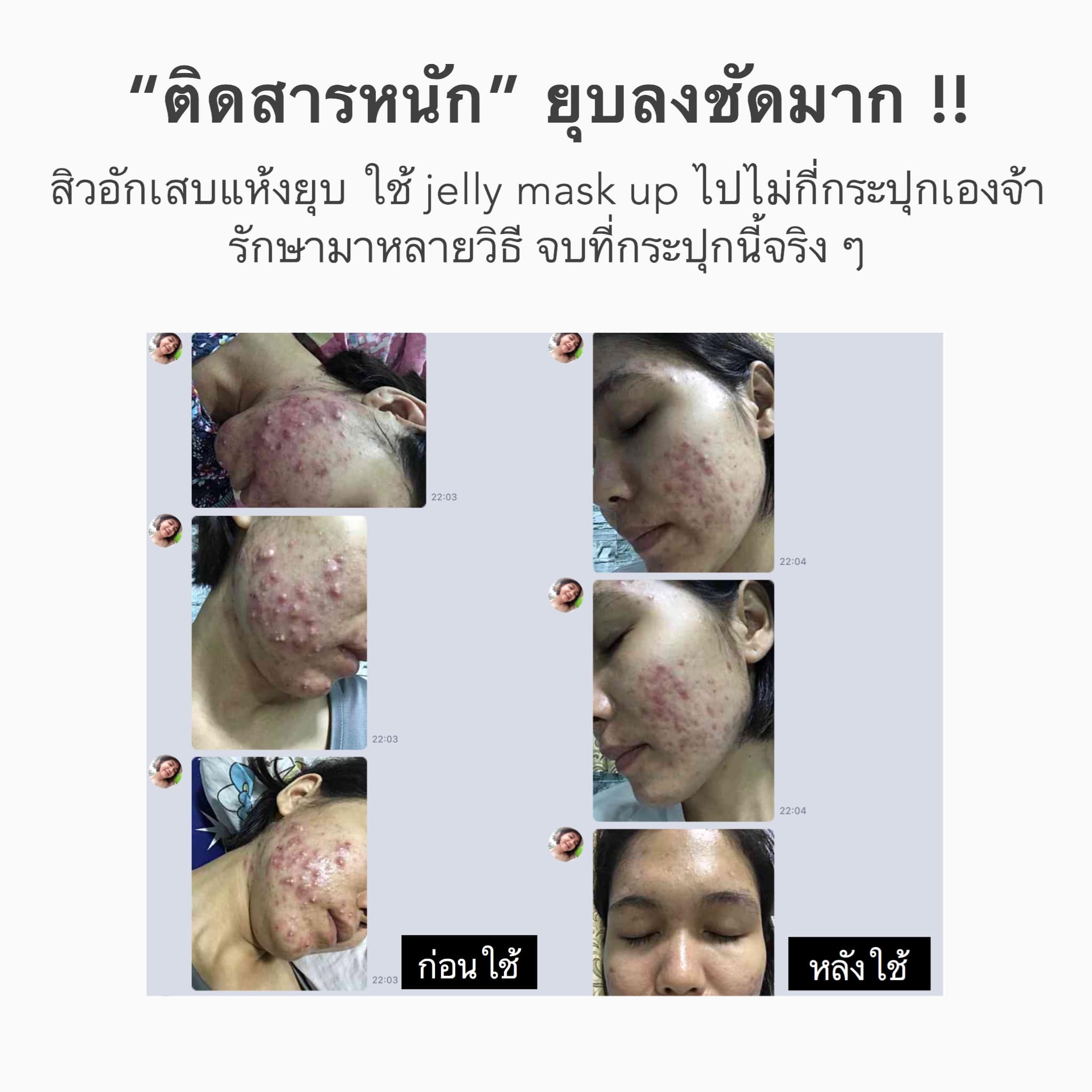 เจลลี่มาร์ค สูตรลดสิวผิวใส Jelly mask up ของแท้ แพ็คเกจใหม่
