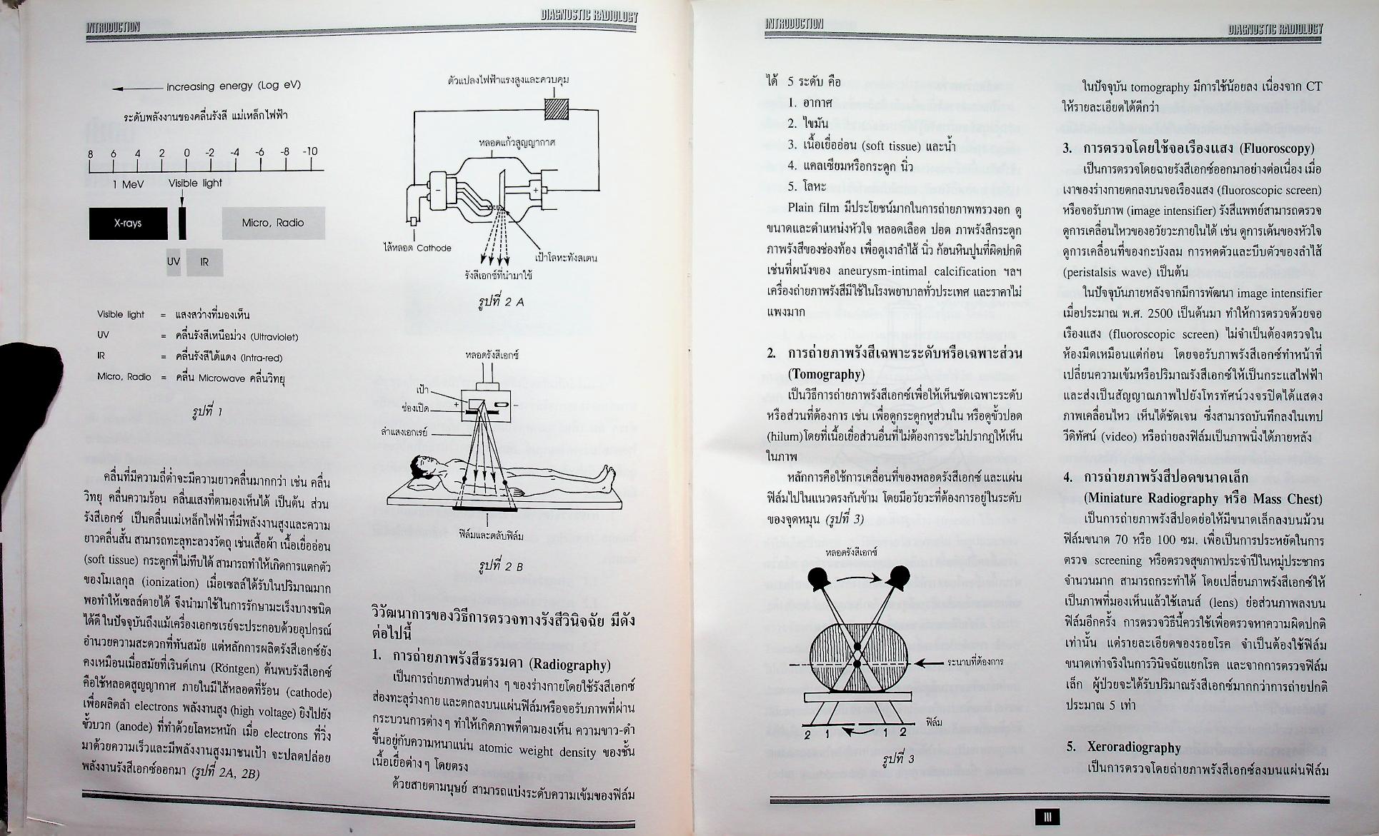 รังสีวินิจฉัย DIAGNOSTIC RADIOLOGY