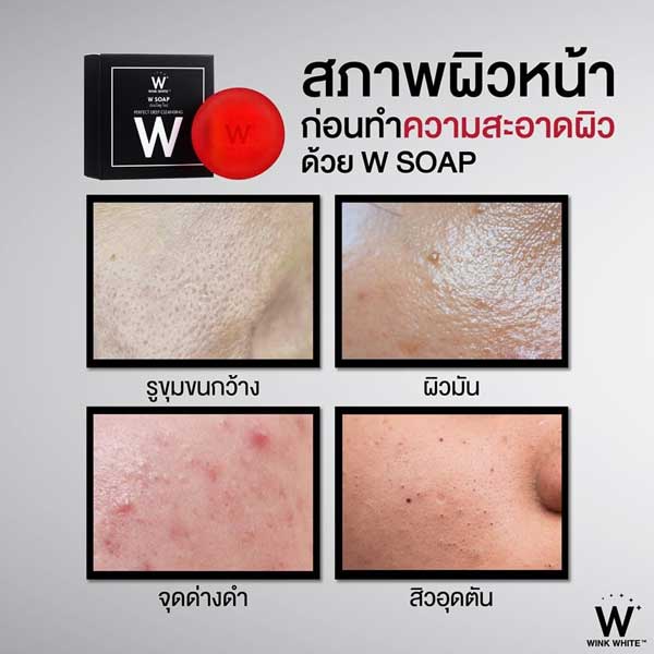 สบู่วิ้งไวท์(กล่องดำ)Wink White W Soap ดับเบิ้ลยู โซป