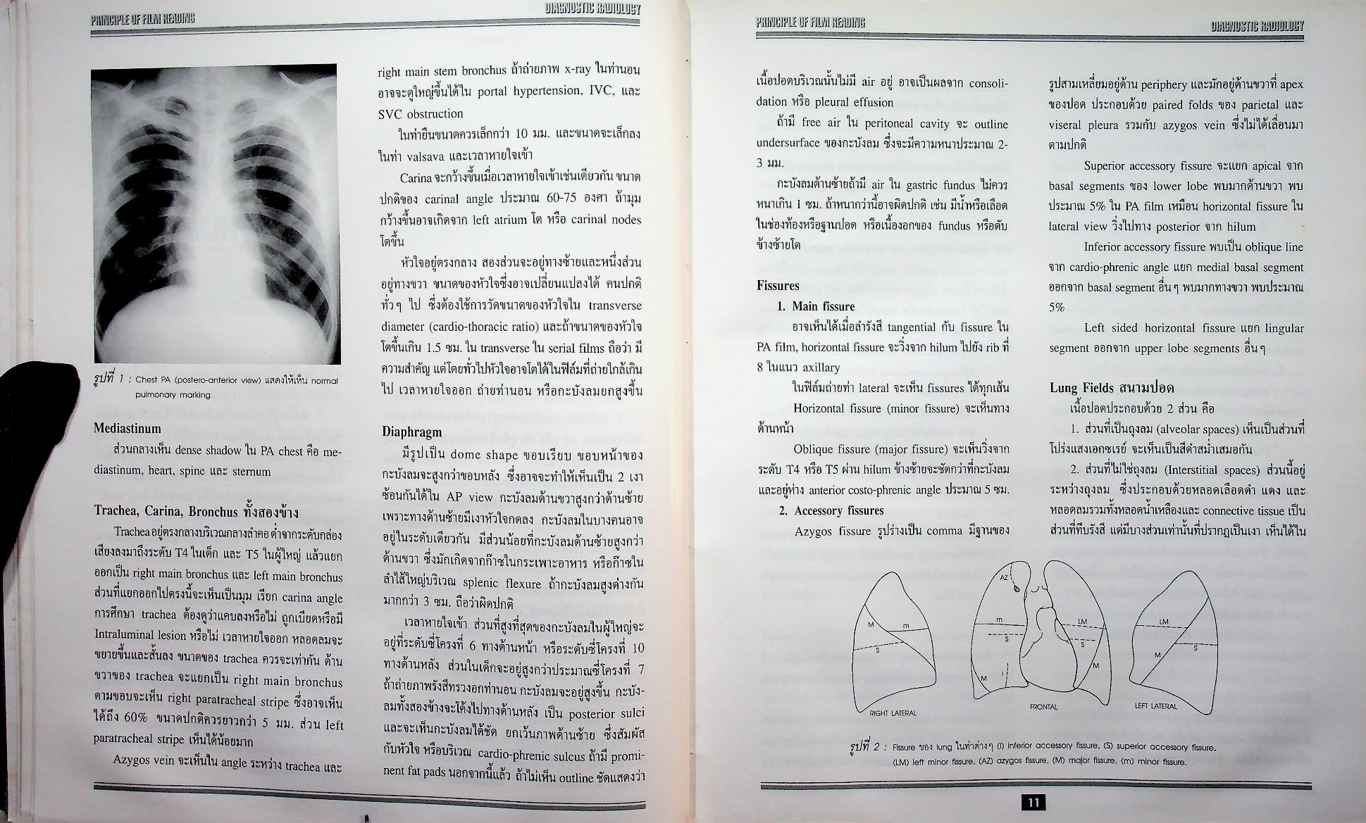 รังสีวินิจฉัย DIAGNOSTIC RADIOLOGY