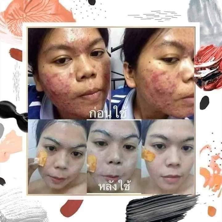 สบู่มะละกอน้ำผึ้ง เอ็นพีม่า สบู่หน้าใส ( แพคเกจใหม่ ) 60กรัม