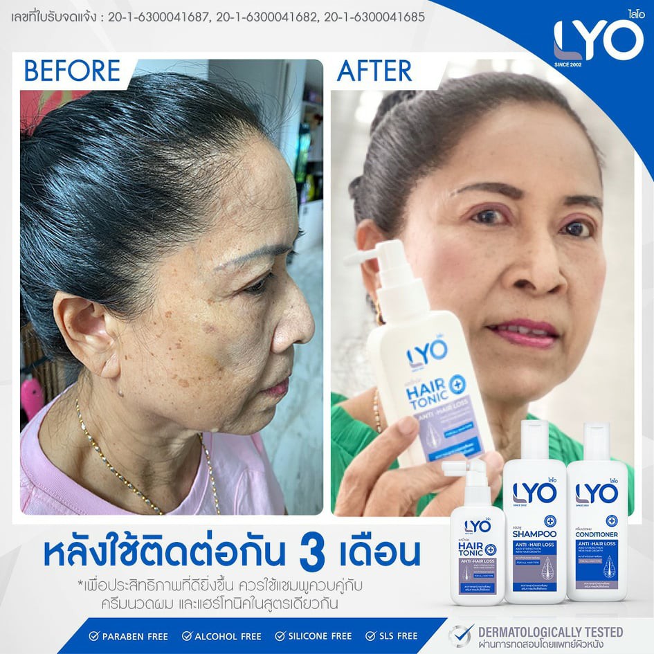 ไลโอ LYOผลิตภัณฑ์บำรุงผมหนุ่มกรรชัย ชุด1แถม2 แฮร์โทนิค+แชมพู +ครีมนวด ยาสระผมลดการหลุดร่วงของเส้นผม