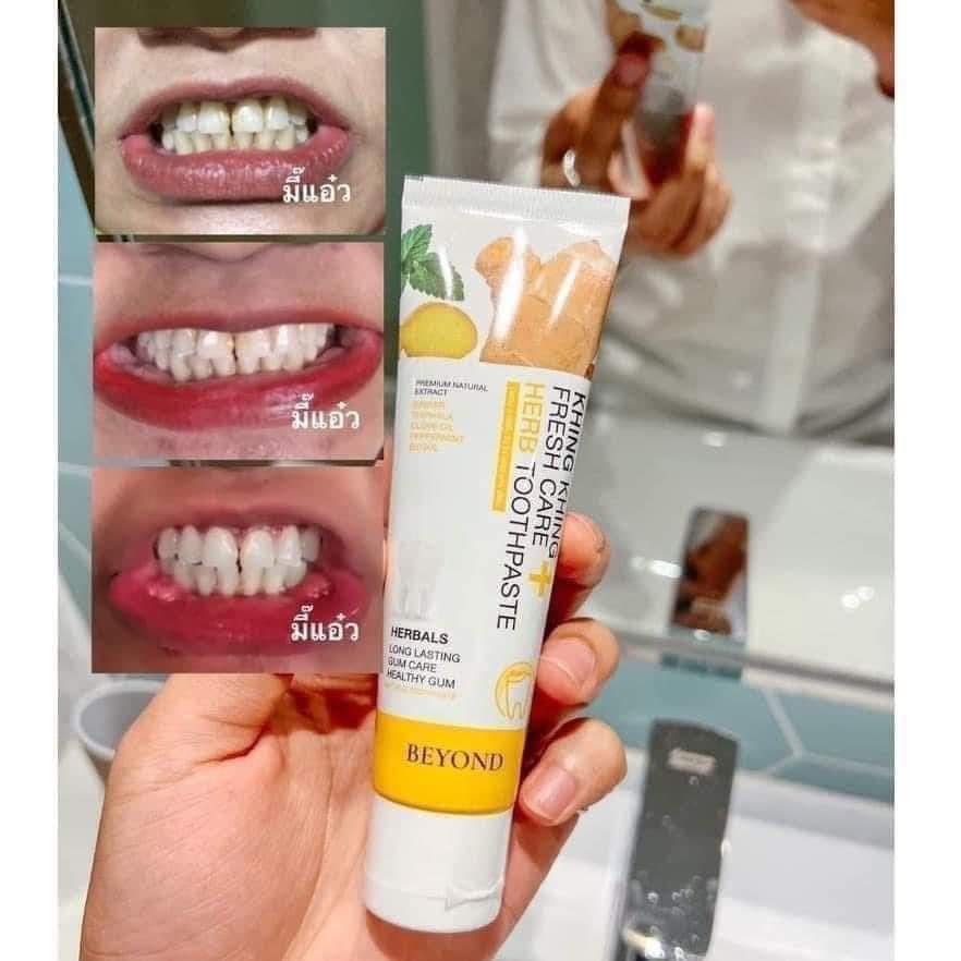 ยาสีฟันขิงขิง บอสหนุ่ม บียอน Khing Khing By Beyond ลดคราบหินปูน ลดกลิ่นปาก (1หลอด)