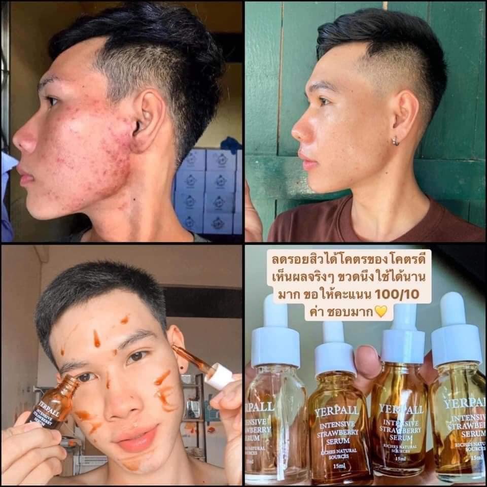 เซรั่มสตอเบอร์รี่ เยอร์พาล Yerpall Straewberry Serum ขนาด 15ml.