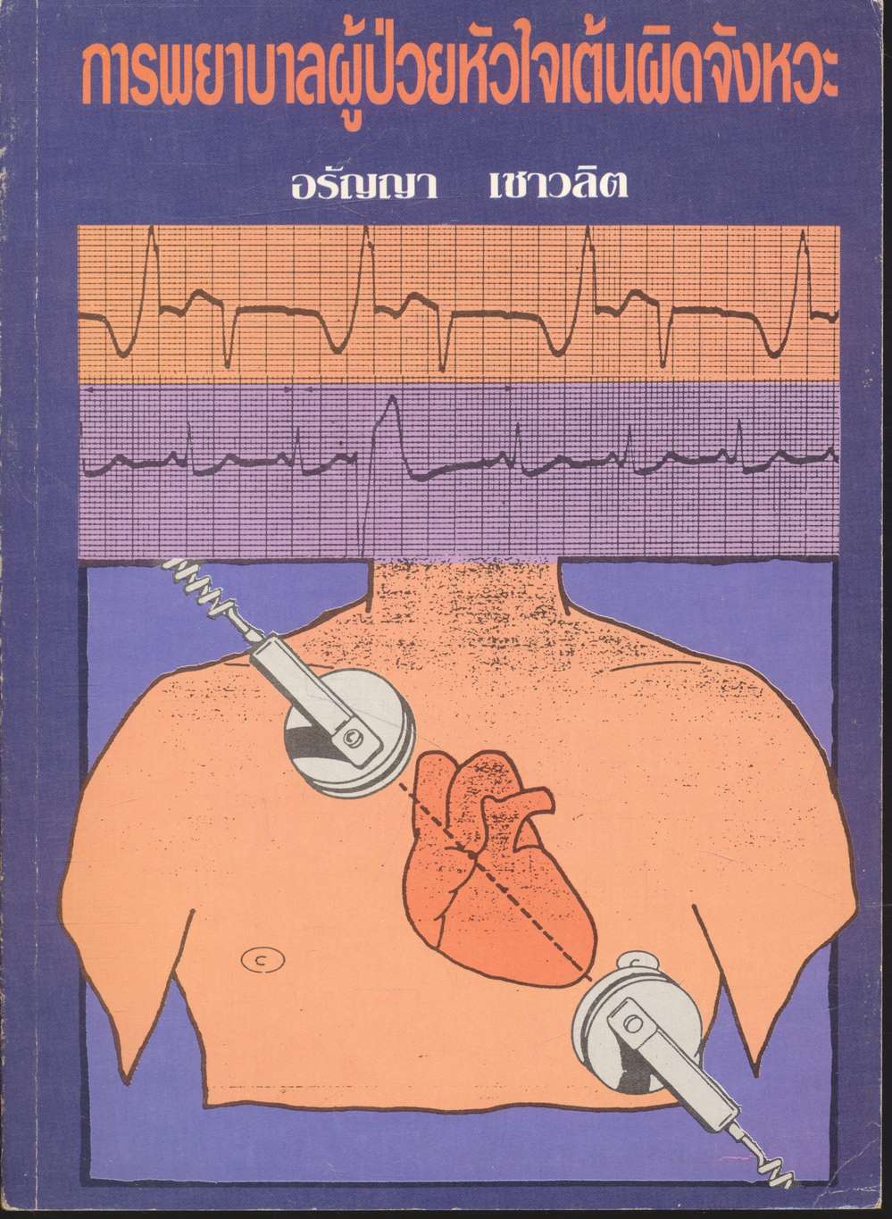 การพยาบาลผู้ป่วยหัวใจเต้นผิดจังหวะ