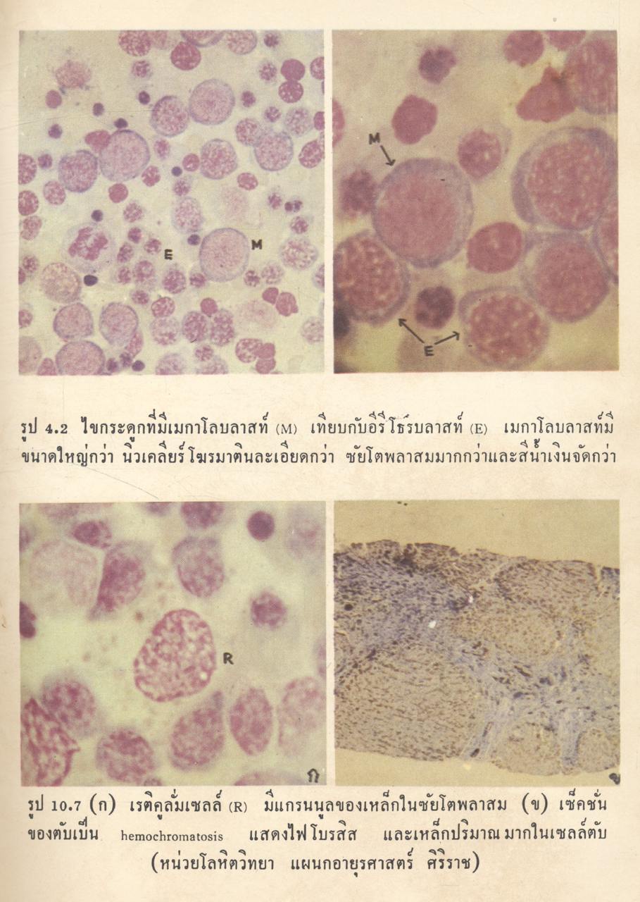 โลหิตวิทยา