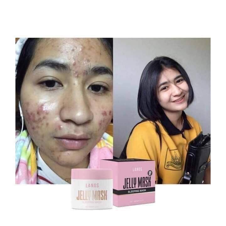 เจลลี่มาร์ค สูตรลดสิวผิวใส Jelly mask up ของแท้ แพ็คเกจใหม่