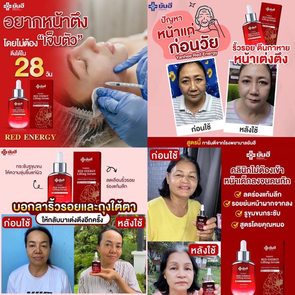 เซรั่มยันฮีแดง เซรั่มยันฮีเรด Yanhee Red Energy Lifting Serum 30ml.