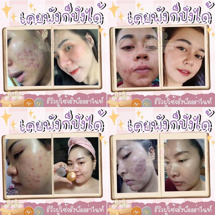 ครีมพีออร่าไนท์ ไวท์เทนนิ่งครีมหน้าใส P aura night whitening cream 5กรัมโฉมใหม่!!