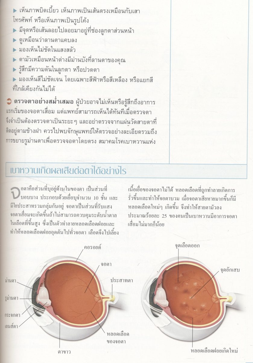 หยุดยั้งและควบคุมเบาหวาน