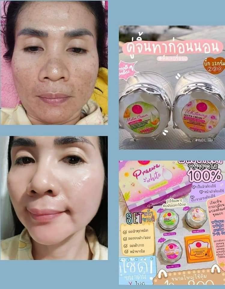 ครีมแพรวาไวท์ ชุด12กรัม ตอบโจทย์ทุกสภาพผิว