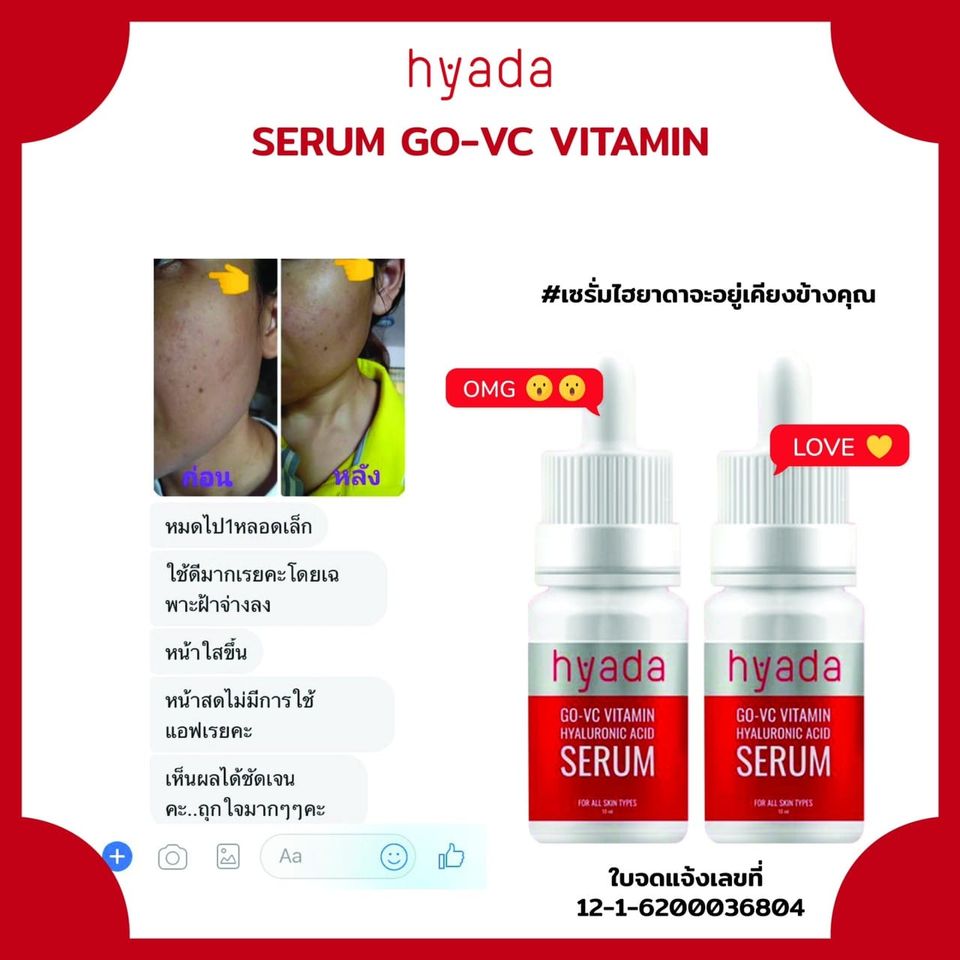 2แถม2 เซรั่มHyadaไฮยาดา โก-วีซี วิตามิน 2ขวด แถมฟรี เจลอโลน้องนะคะ1ซอง+สบู่คอลลาเจน1ก้อน