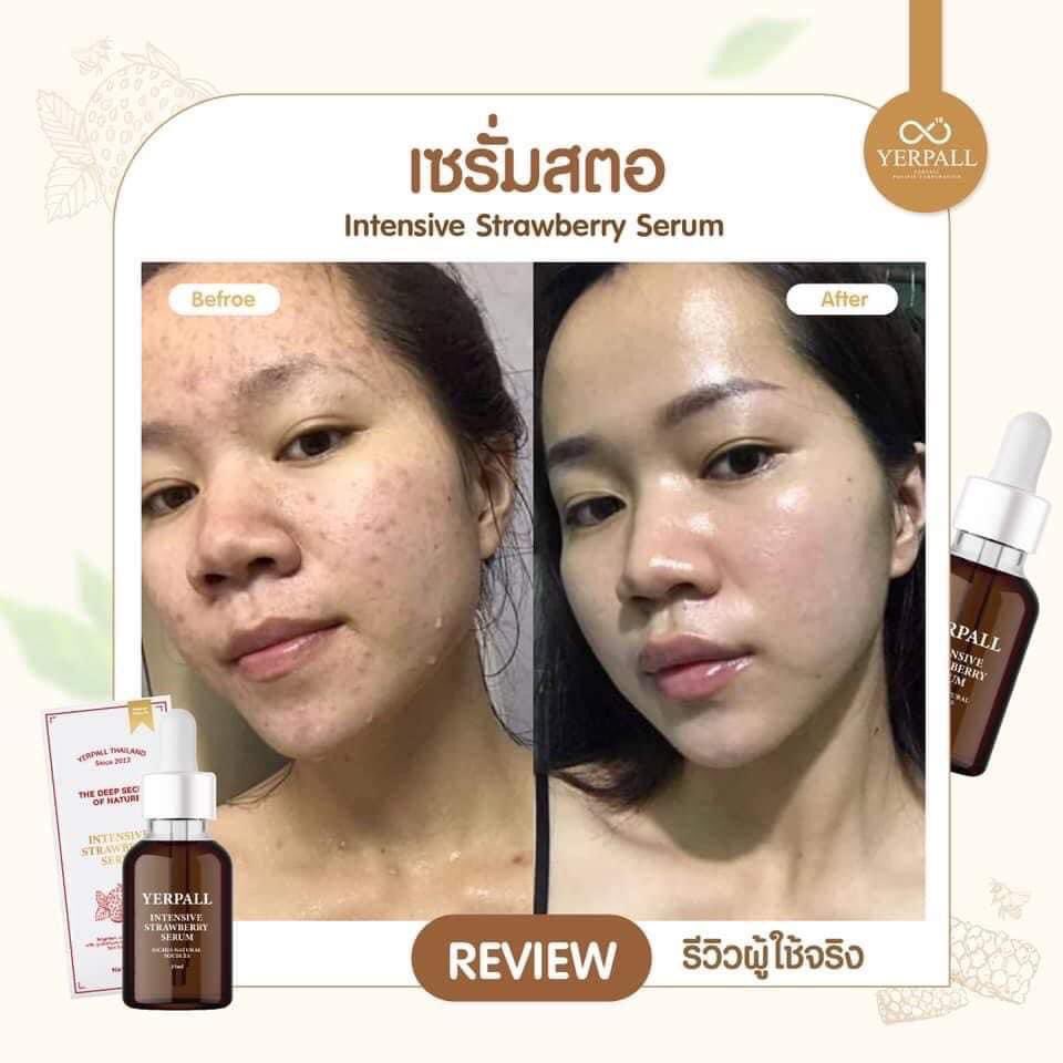 เซรั่มสตอเบอร์รี่ เยอร์พาล Yerpall Straewberry Serum ขนาด 15ml.