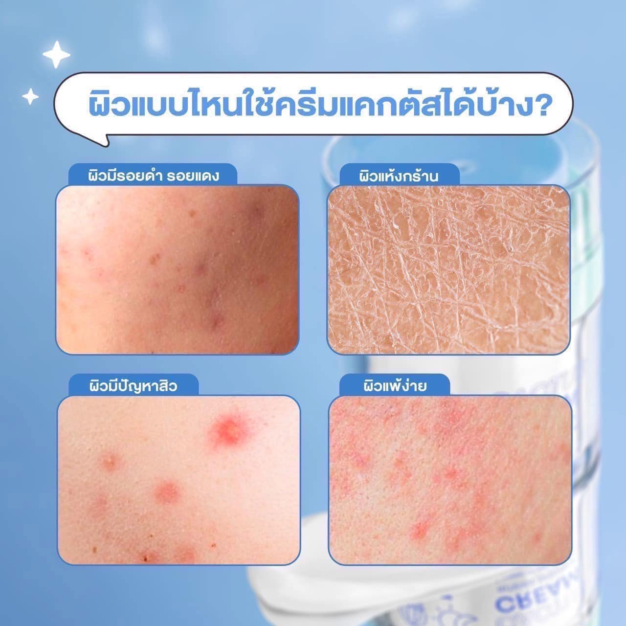 ครีมบำรุงผิวหน้าแคคตัส CACTUS CREAM 30g สำหรับการดูแลผิว - Moisturizer, Skincare