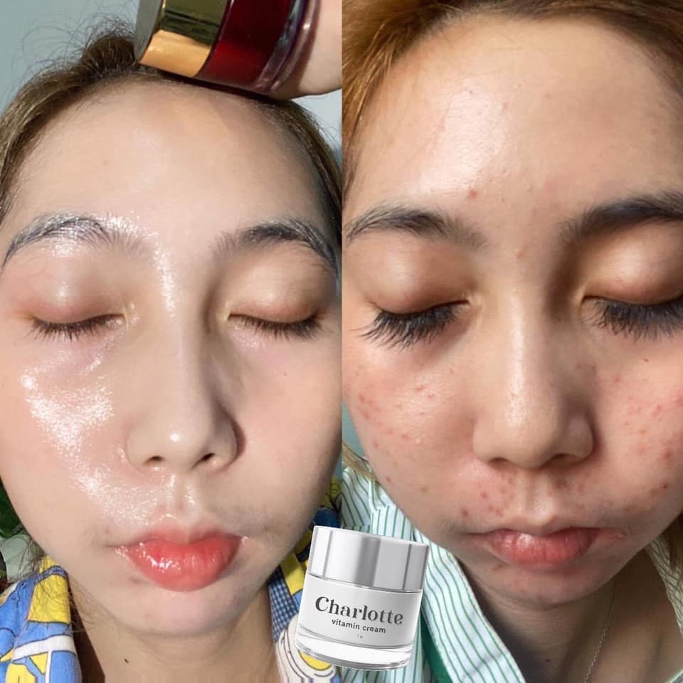 ครีมชาร์ลอตต์ วิตามินสด ของแท้100%7g.