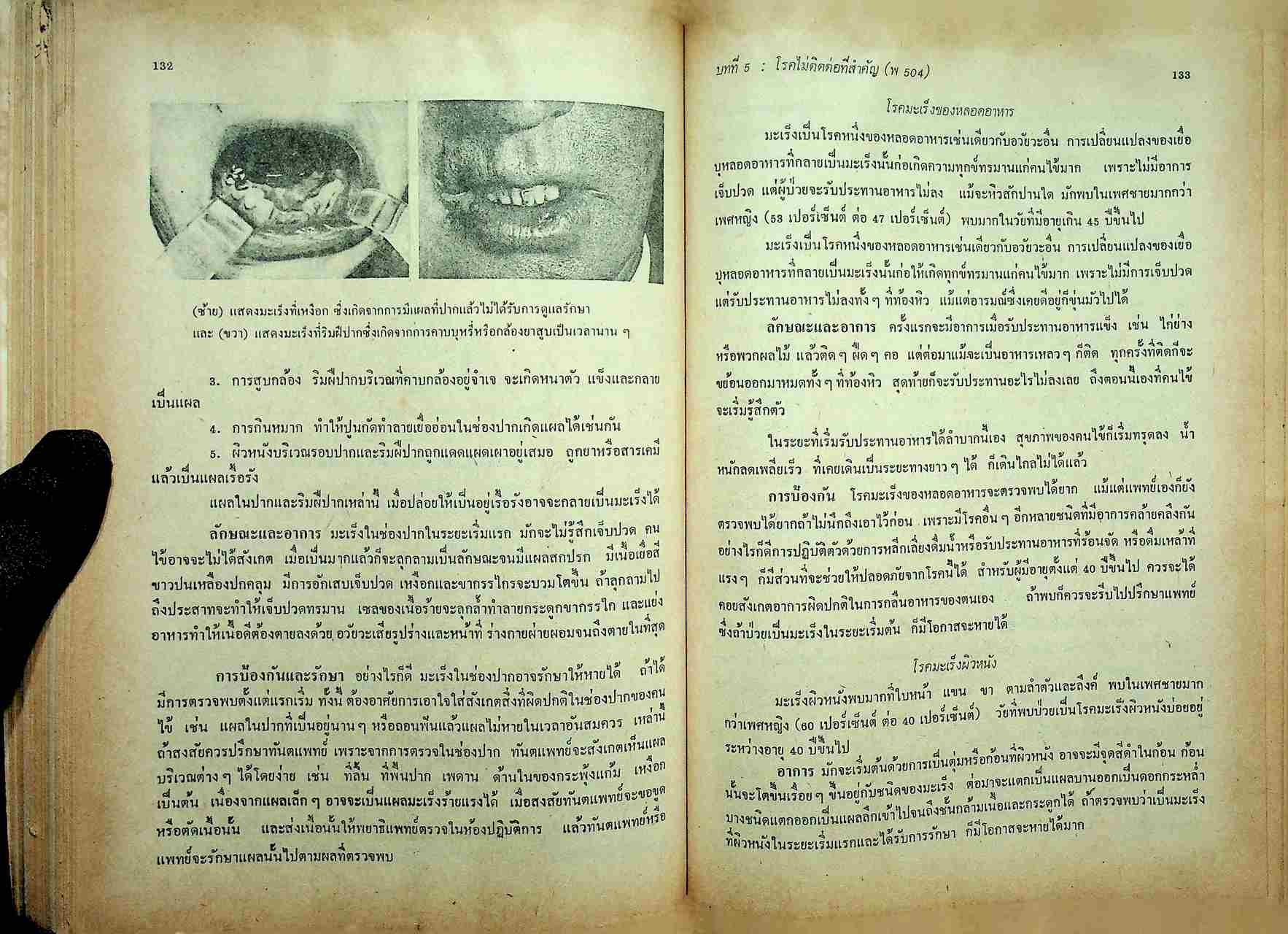 สุขศึกษา พลานามัย พ 503 - พ 504 ตามหลักสูตรประโยคมัธยมศึกษาตอนปลาย 2518
