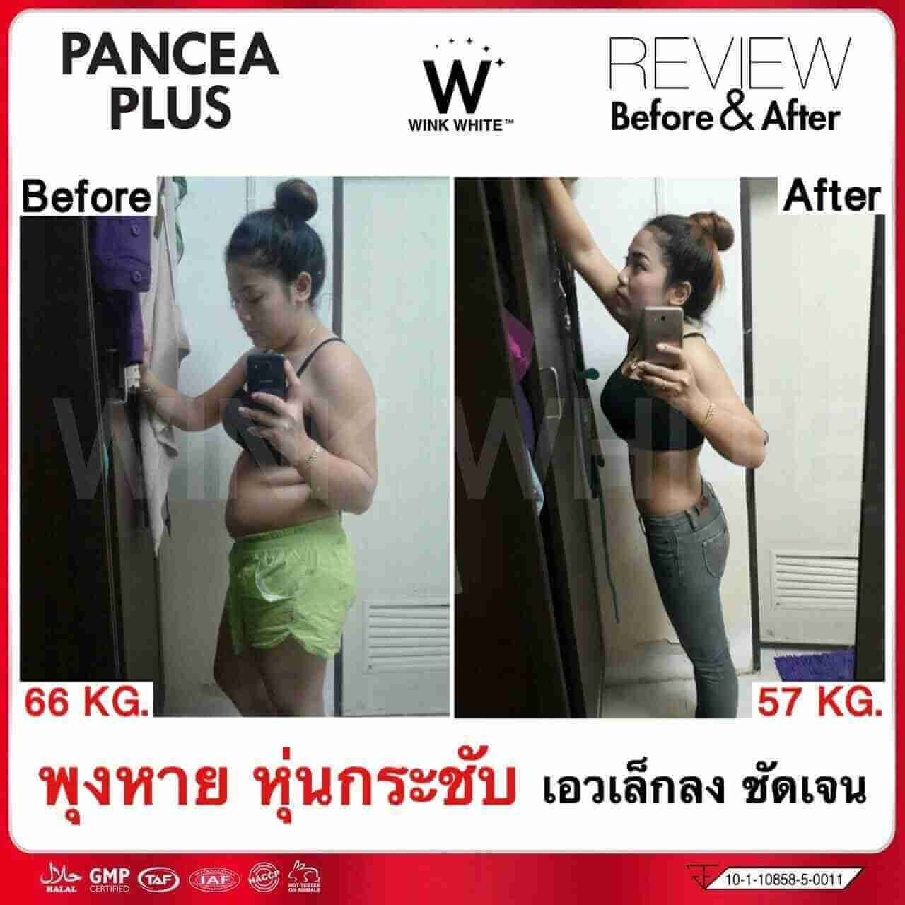 1แถม1อาหารเสริมควบคุมน้ำหนักxs วิ้งไวท์ ตัวช่วยระบบเผาผลาญ เน้นเบิร์น เน้นสลายไขมัน