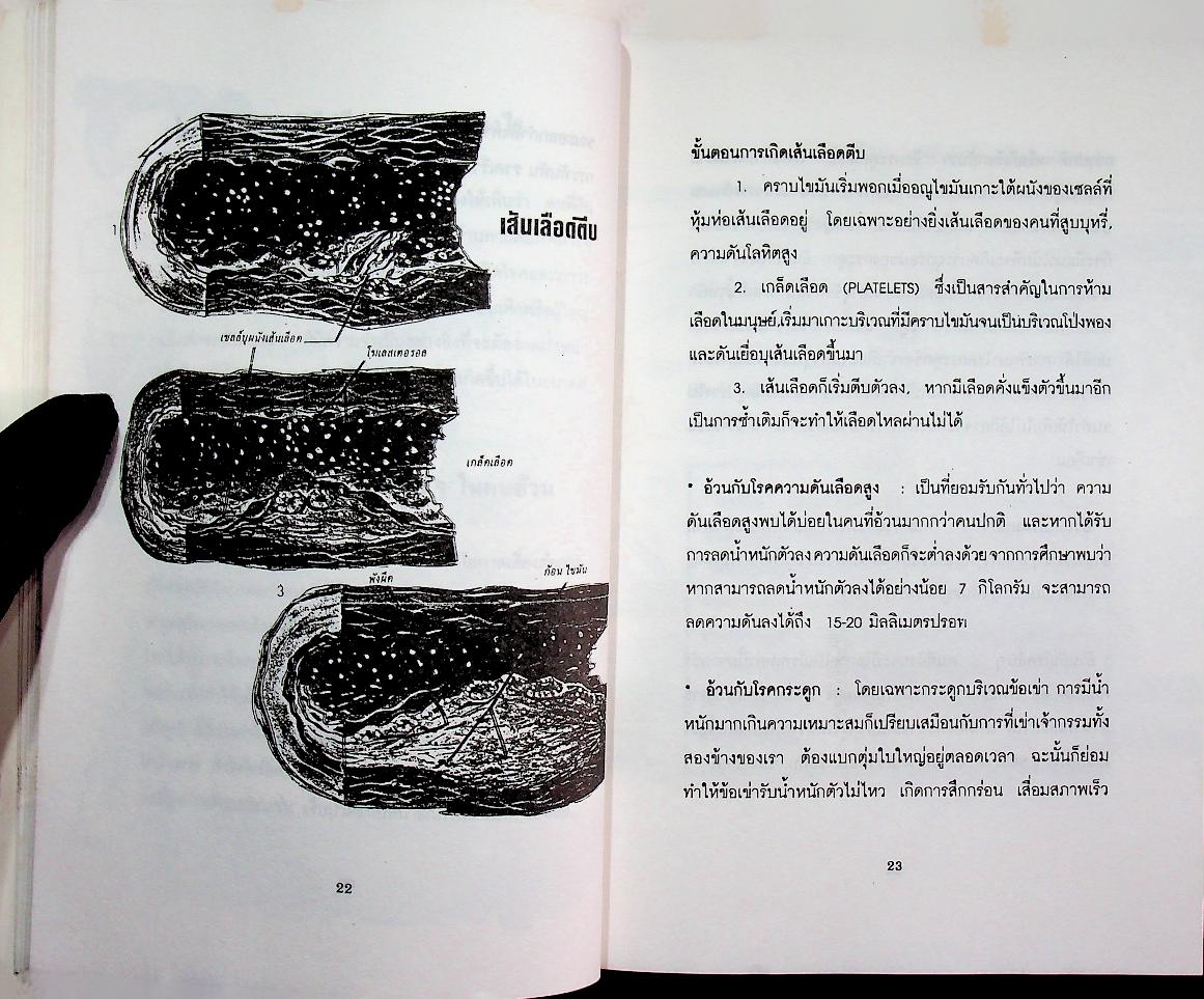 โครงการตำราสุขภาพ เล่มที่ ๑ คลีนิคคนอ้วน