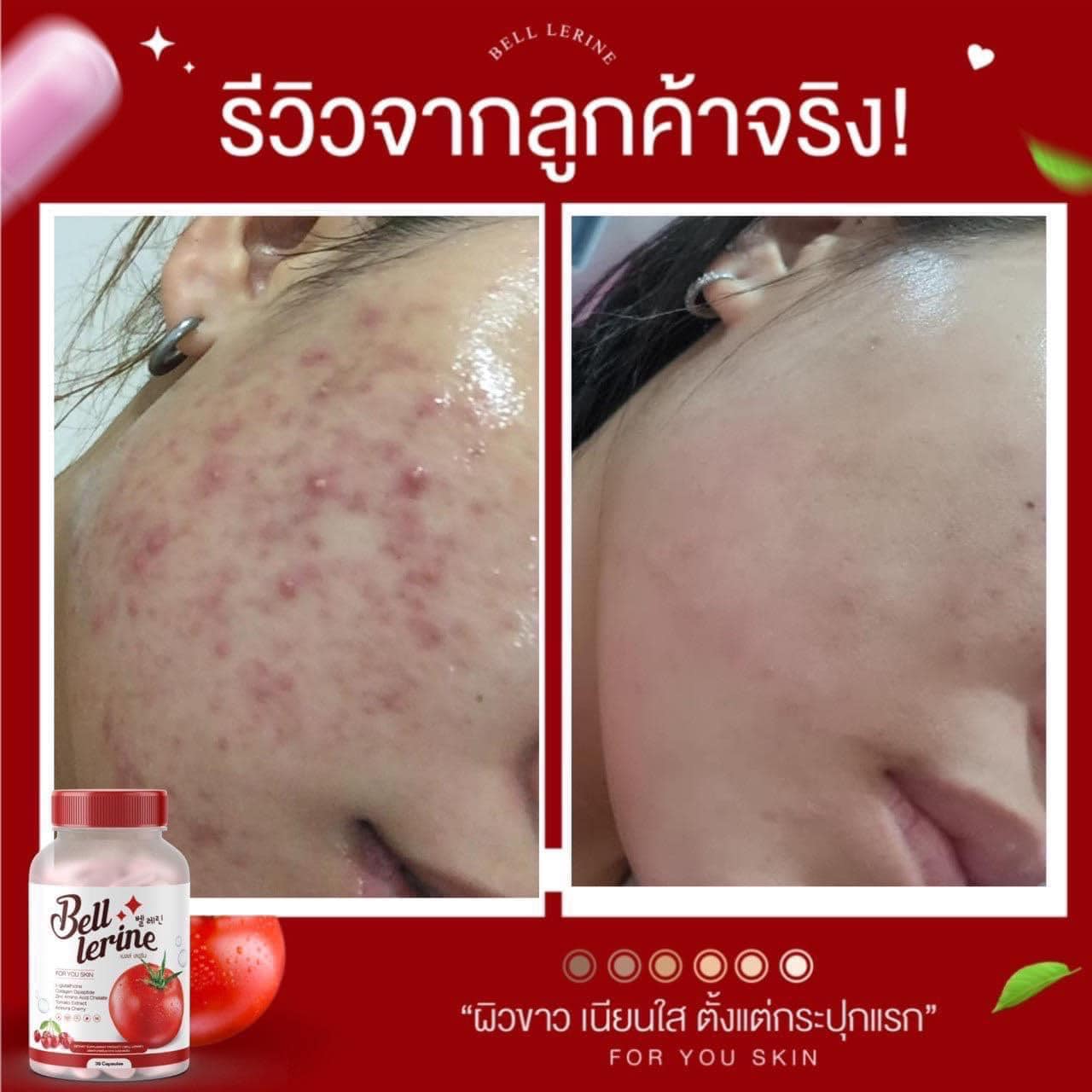 กลูต้าเบล เบลล์เลอรีน กลูต้าผิวใส Bell Lerine วิตามินคุณหมอ ผสมคอลลาเจน ลดรอยสิว ริ้วรอย ฝ้า กระ