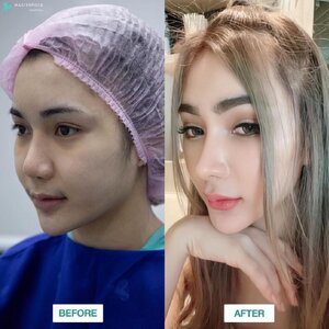 แก้ไขรูปหน้าเหลาหน้า โทร 095-5266242 เสริมหน้าอก เสริมจมูก ทำตา2ชั้น สำหรับผู้หญิงเรา ต้องสวย เพราะความสวยจะเปลี่ยนชีวิต
