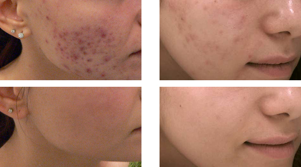 HerbalFresh | Եѳҧ˹ | ʺҧ˹ | ʺҧ˹ HerbalFresh | ѡ | ѡҽ | Ŵ | ͧѹ | Ŵ | Ŵشҧ